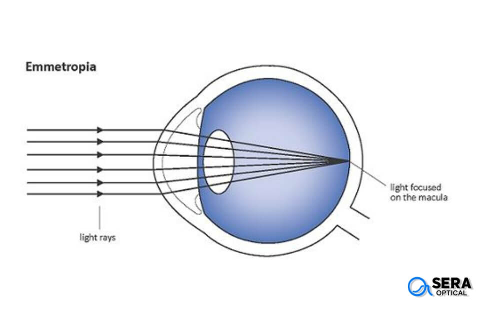 how vision works with eyeglasses
